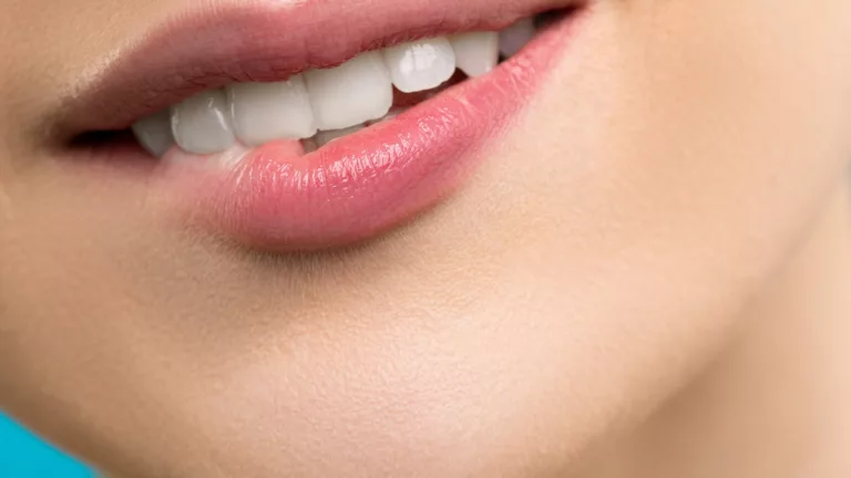 Understanding and Addressing Front Tooth Cavities