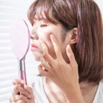 Navigating the Acne-Dairy Connection