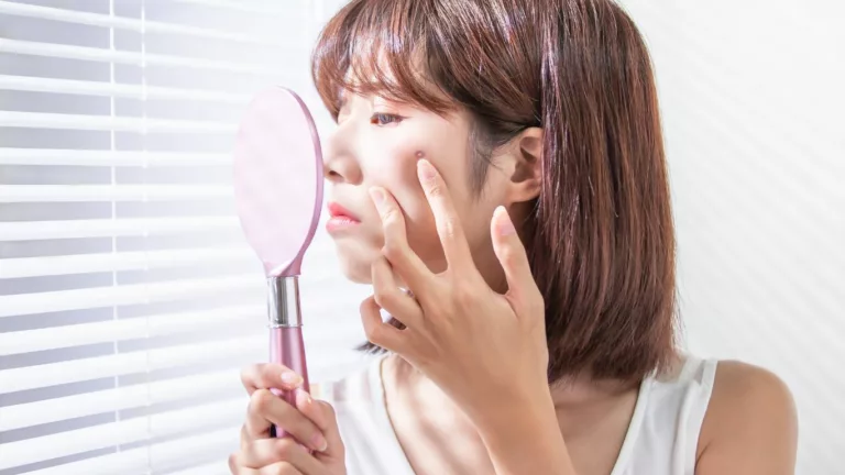 Gentle Exfoliation for Sensitive Acne-Prone Skin