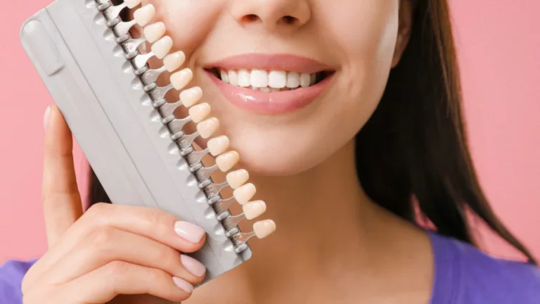 Can Porcelain Veneers Stain? Unveiling the Truth