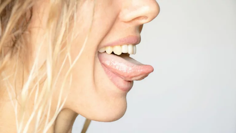 Understanding GERD and Its Impact on the Tongue