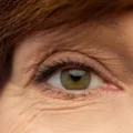Understanding Eye Floaters After LASIK Surgery - Causes and Management
