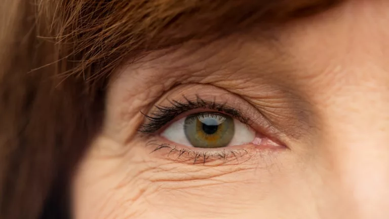 Understanding Eye Floaters After LASIK Surgery – Causes and Management