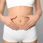 What to Expect During the Liposuction Healing Process
