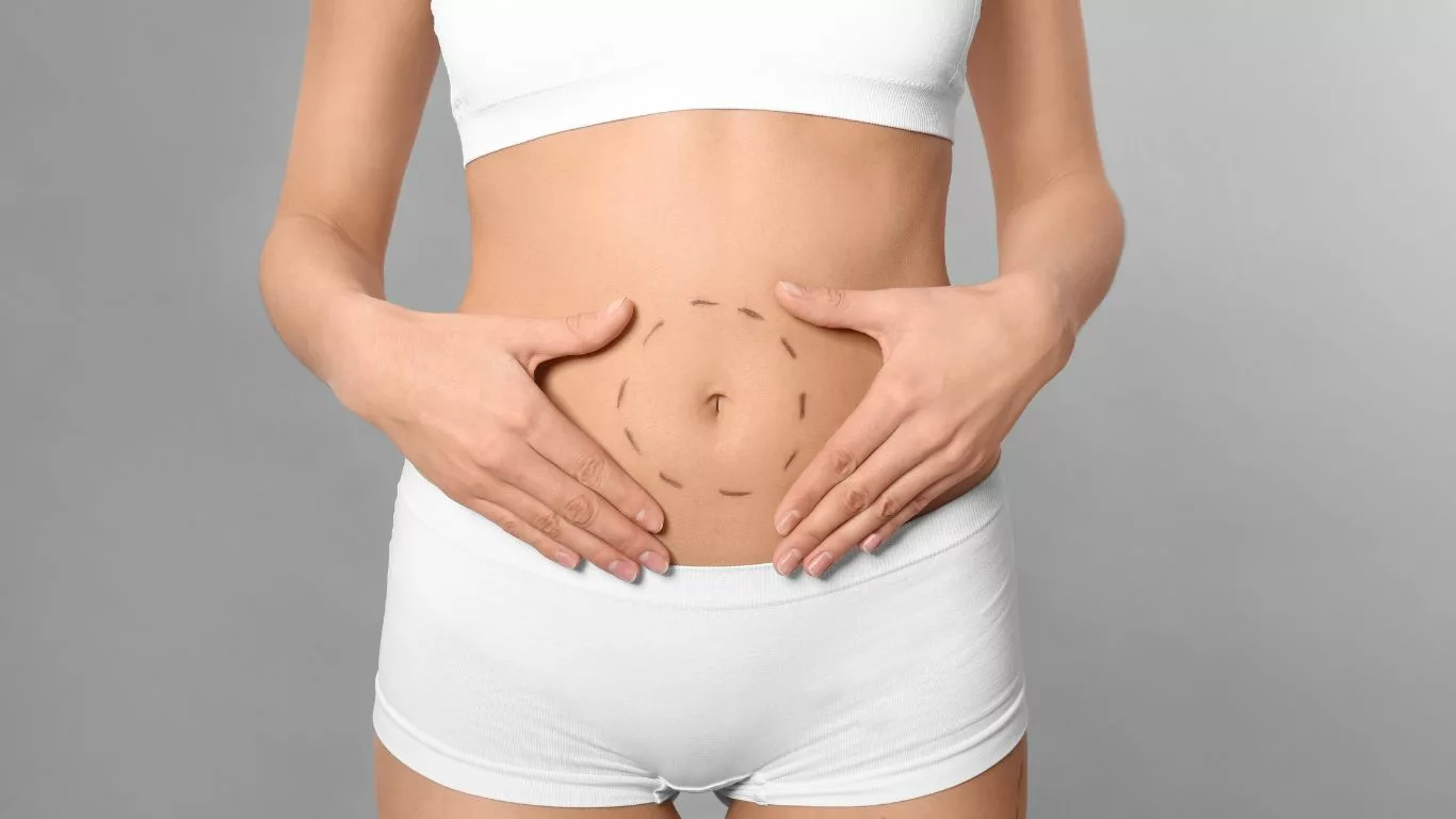 What to Expect During the Liposuction Healing Process