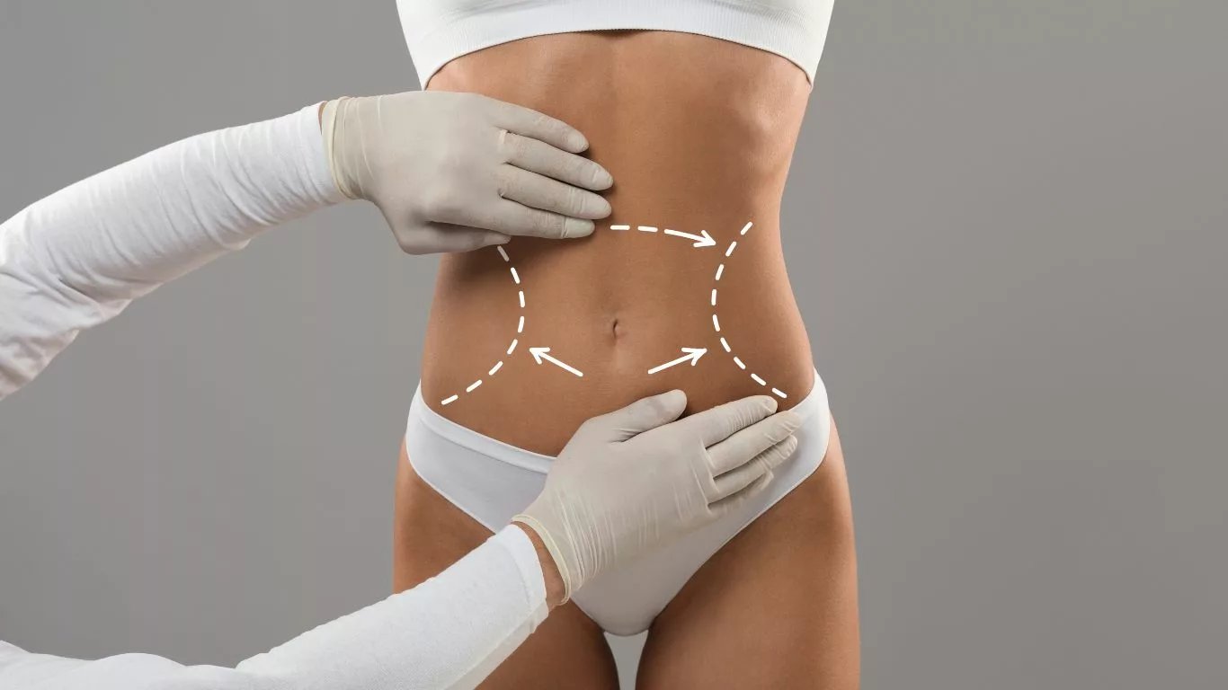 Understanding the Average Cost of Stomach Liposuction