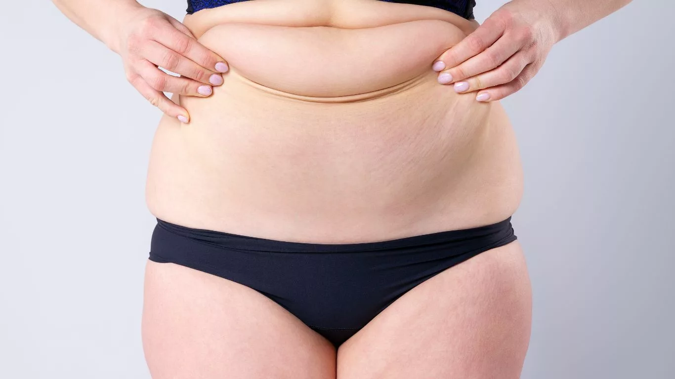 Which procedure is suitable for targeting stubborn belly fat?