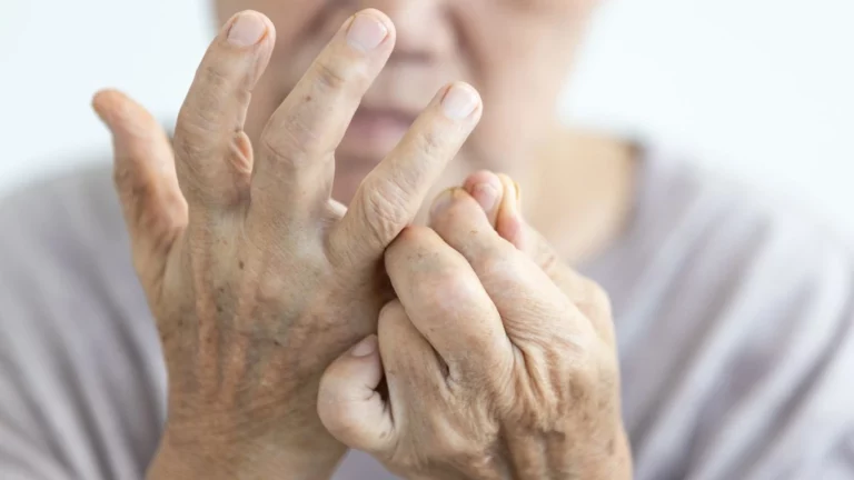 Rheumatoid Arthritis and Autoimmune Diseases: A Comprehensive Guide