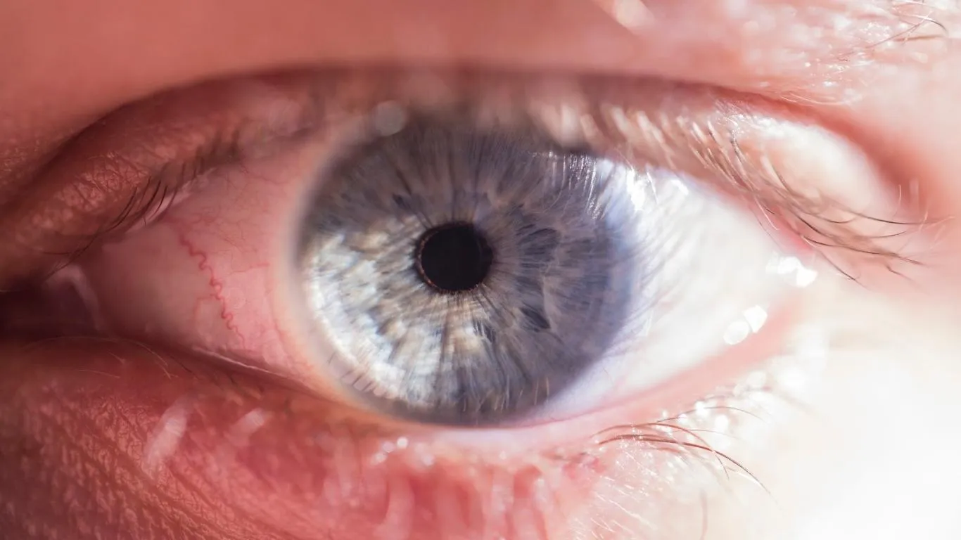 Eye under examination after new glasses