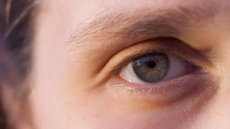 Why Floaters Get Worse While Watching Snowfall Through Windows