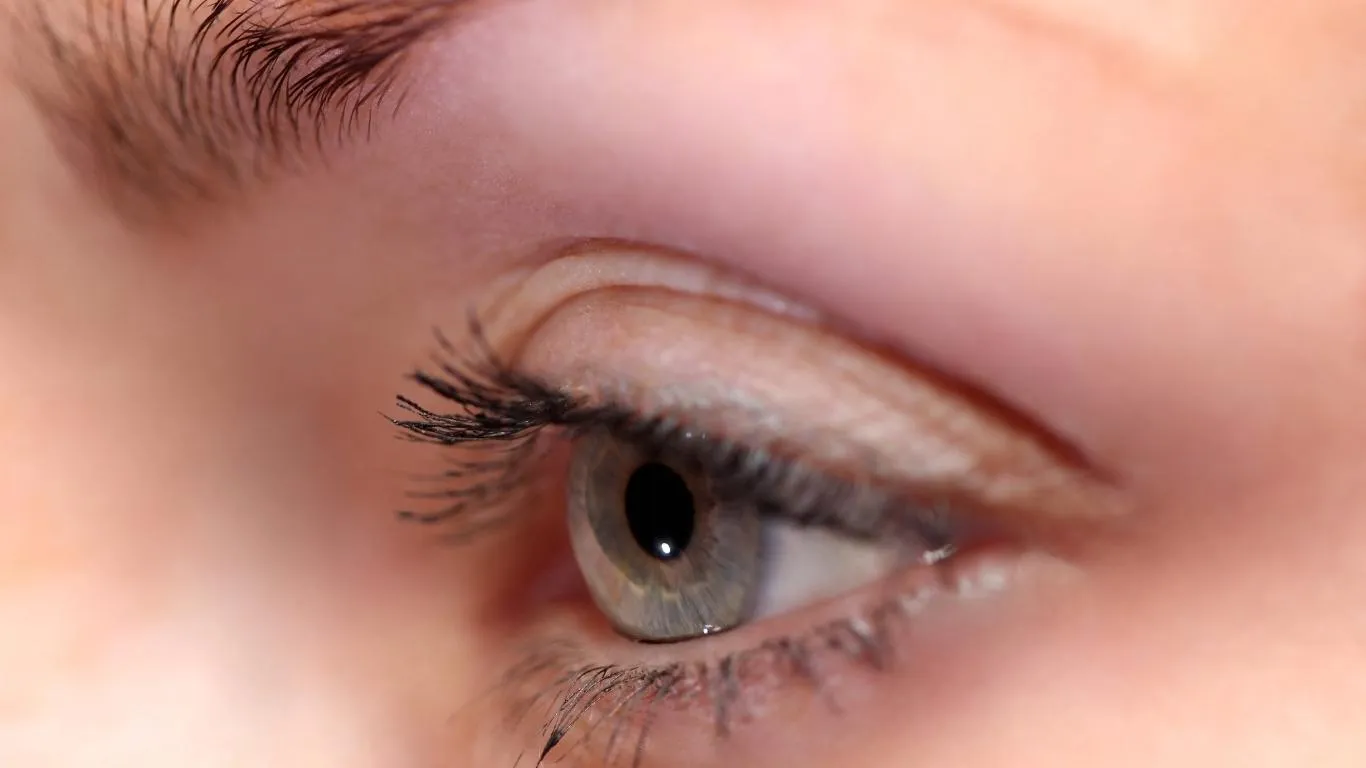 Surgical options for persistent floaters