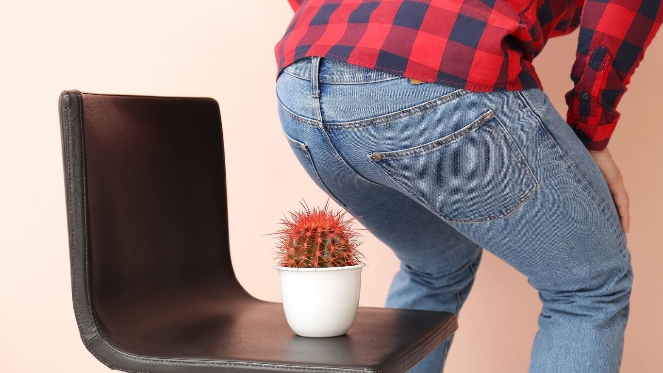 Illustration showing internal and external hemorrhoids